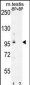 PDPR Antibody (C-term)